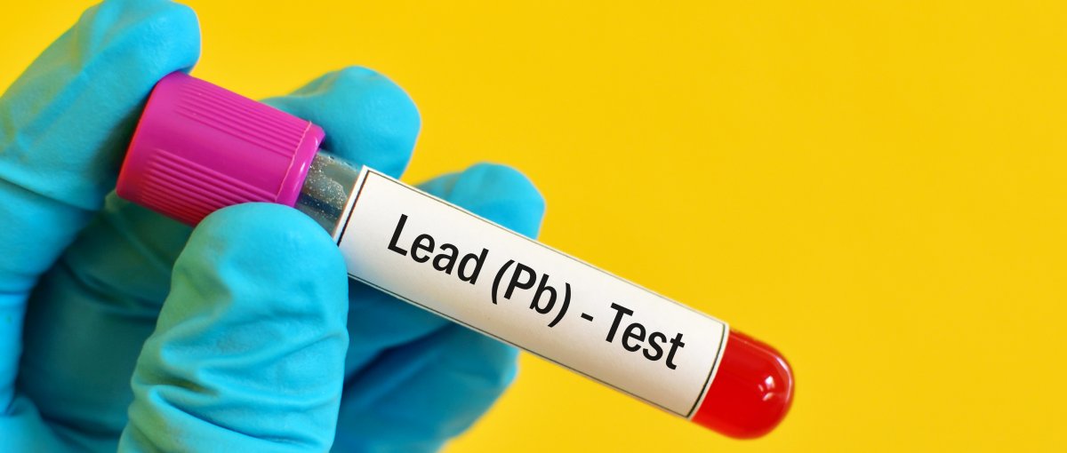 HSE Lead Medicals & Testing Lloyd Occupational Health